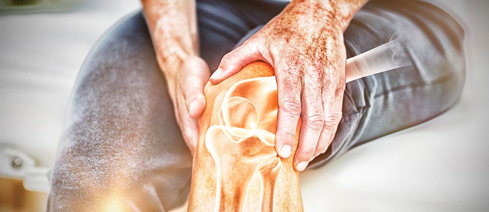 ¿Su dolor significa que es hora de un reemplazo de rodilla?