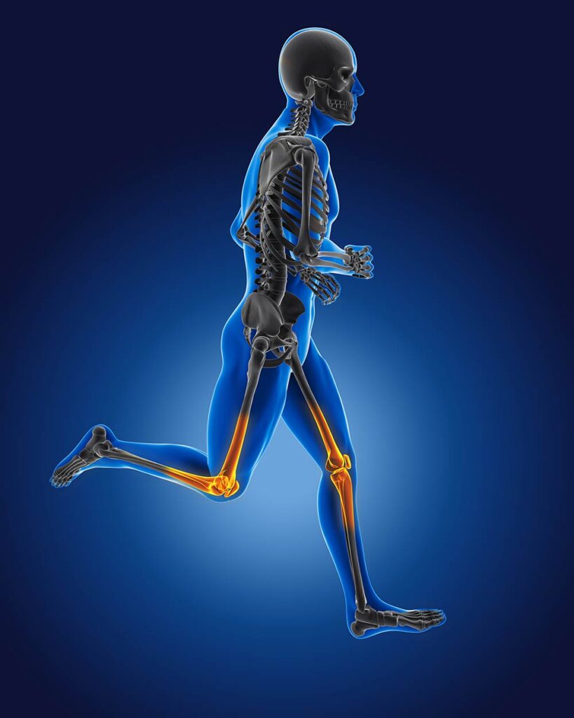 ¿Una dieta antiinflamatoria afecta la osteoporosis y reduce el riesgo de fracturas?