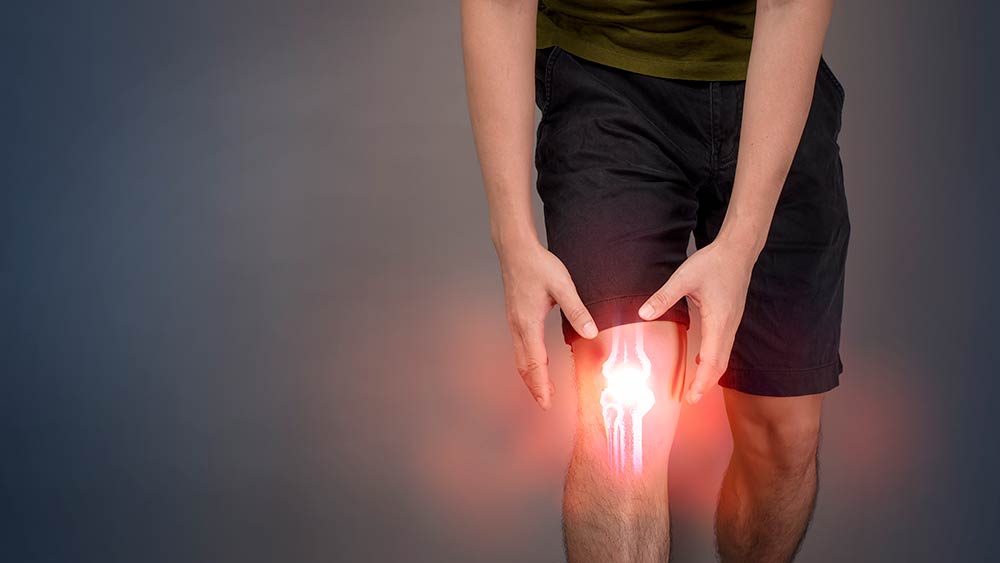 Lesión explicada: artritis de rodilla u osteoartritis (y cómo vivir con ella)