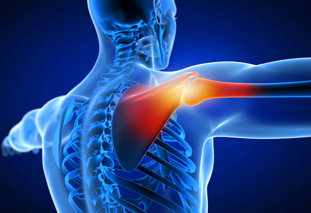 Beneficios de la rehabilitación del dolor de hombro