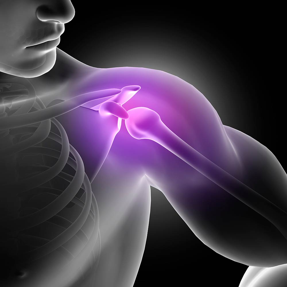 Beneficios de la rehabilitación del dolor de hombro