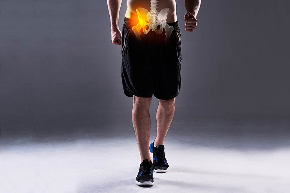 Dolor de cadera por correr: posibles causas