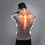 Escoliosis ¿La curvatura en mi columna vertebral está causando mi dolor de espalda?