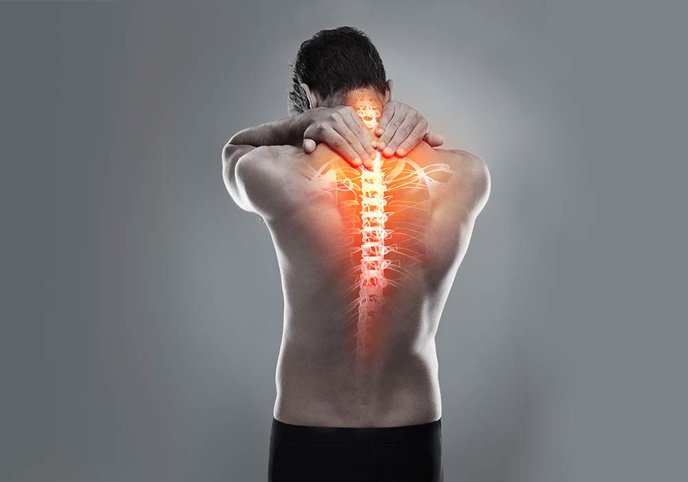 Escoliosis ¿La curvatura en mi columna vertebral está causando mi dolor de espalda?