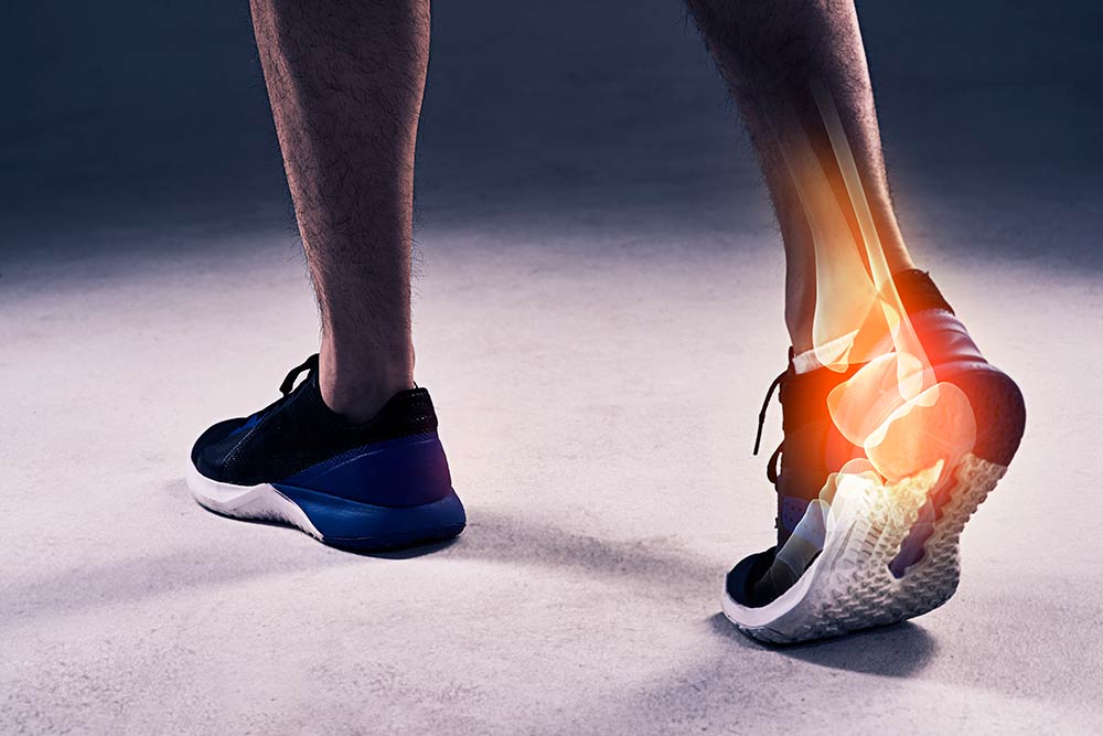 ¿Puede la exostectomía de tobillo ayudar a tratar la artritis de tobillo?